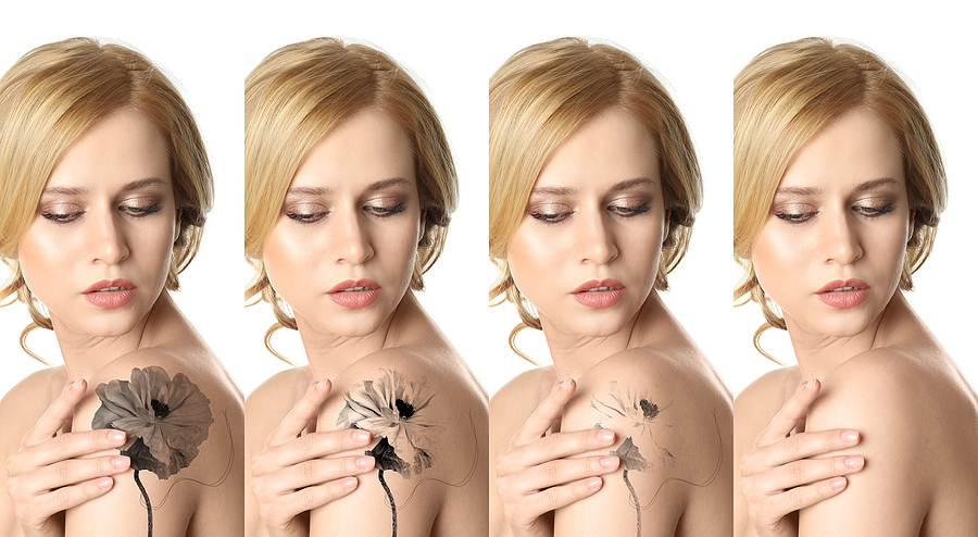 Your Complete Guide to Tattoo Removal & Coverup